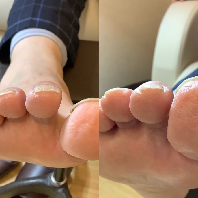 小さい爪も