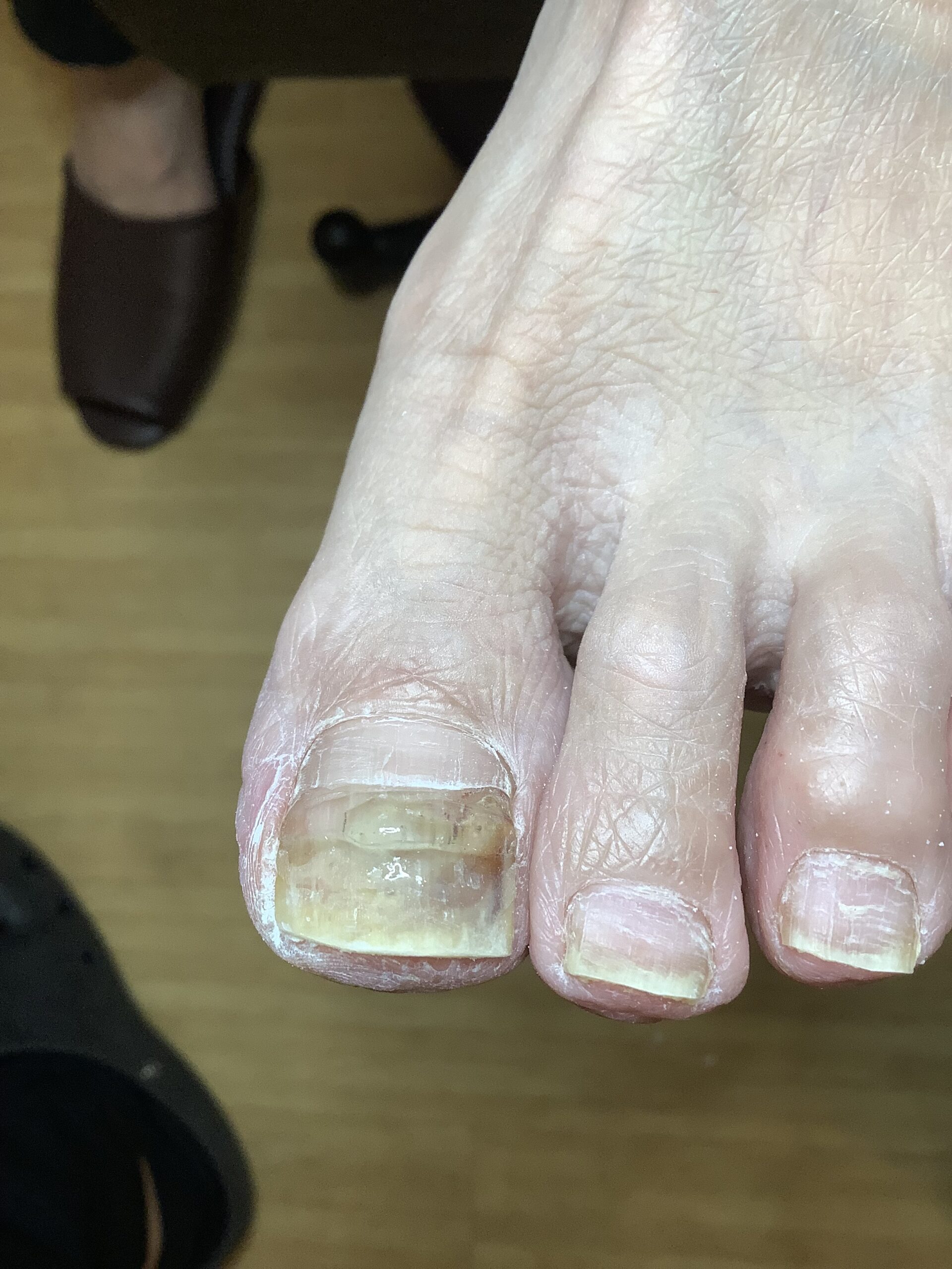 しっかり指に体重をかけると…