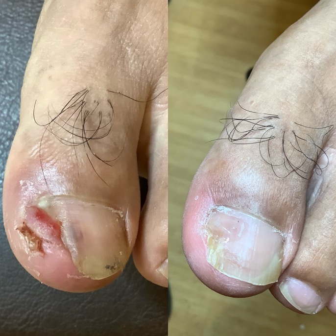 皮膚科に半年通院したけど