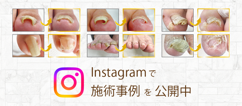インスタ事例
